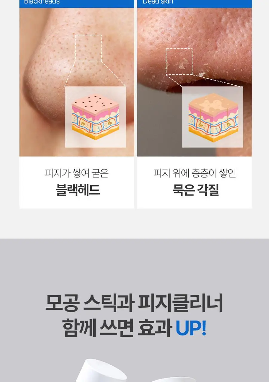 [블랙헤드제거] 메디필 엑스트라 슈퍼9 액티브 스틱 상세페이지 17